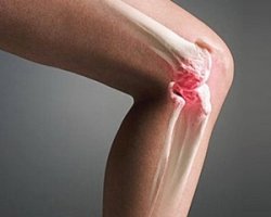 методы замены коленного сустава в израиле